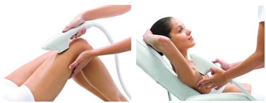 Fotoepiliacija – efektyvus ir neskausmingas plaukelių šalinimo būdas